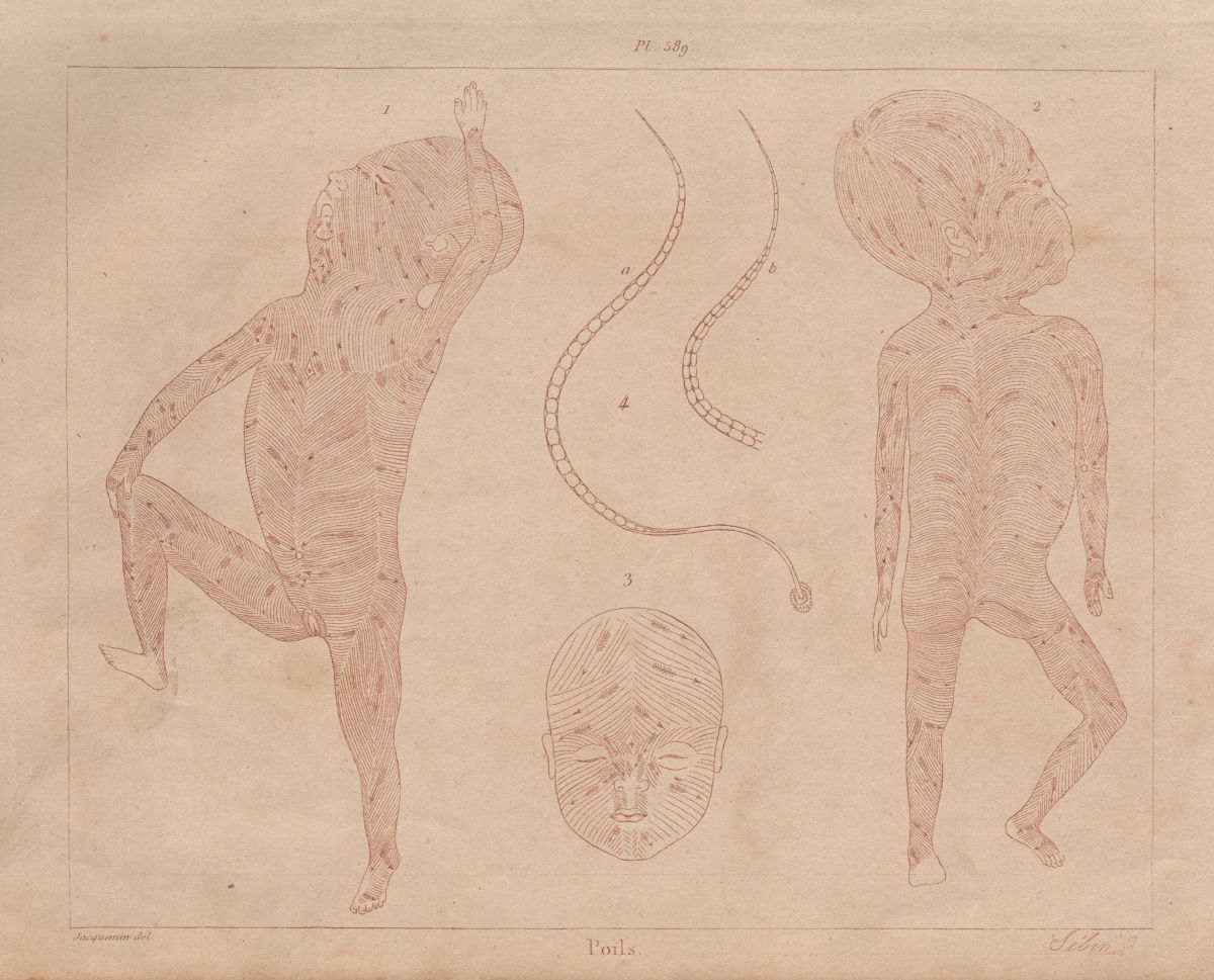 HUMAN HAIR GROWTH. Poils. Hair whorls. Follicle direction 1833 old print