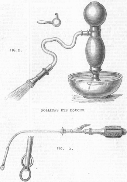 Associate Product SURGERY. Follin eye douche; Plolypotome, larynx, antique print, 1867
