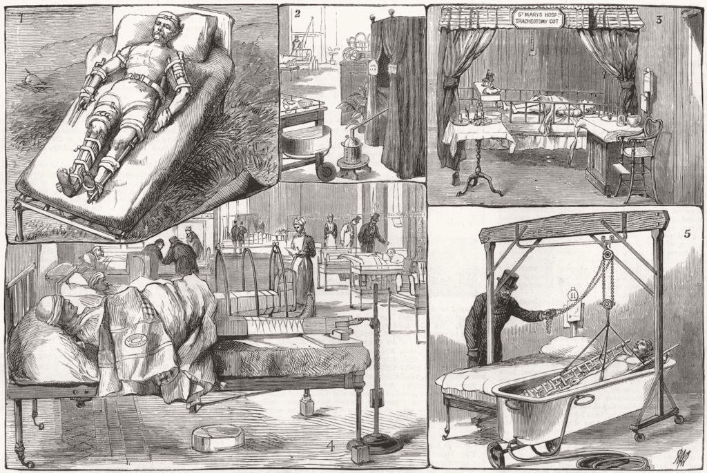 HOSPITALS. Extempore dressing;Ward Tent kit Guy's,St Mary's;Bath lift Mddx 1881