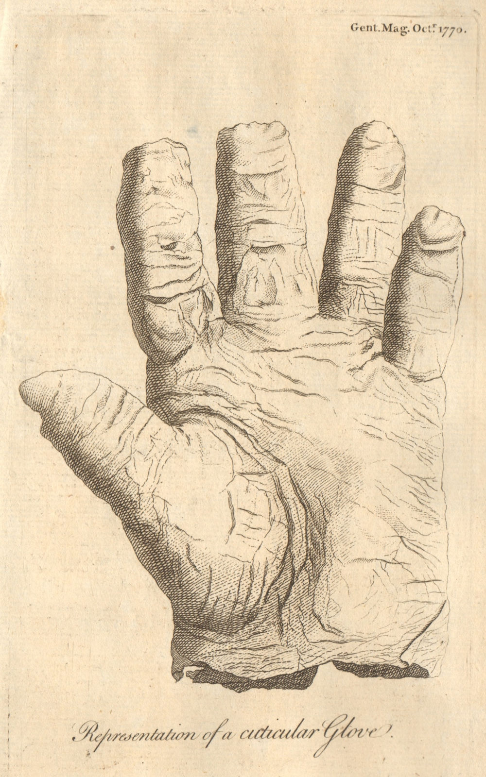 A cuticular glove, being the skin of a man's hand. Biology 1770 old print