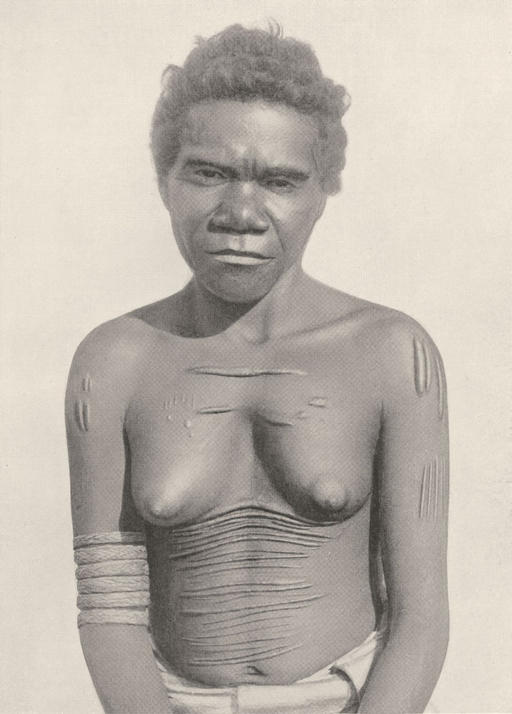 AUSTRALIA. Australia. Cicatrization; custom of making scars on the body 1900