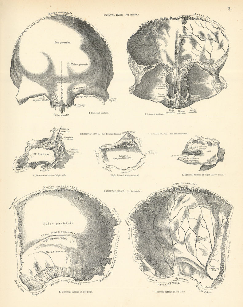 Anatomy. Frontal Bone. Ethmoid Bone. Parietal Bone 1880 old antique print