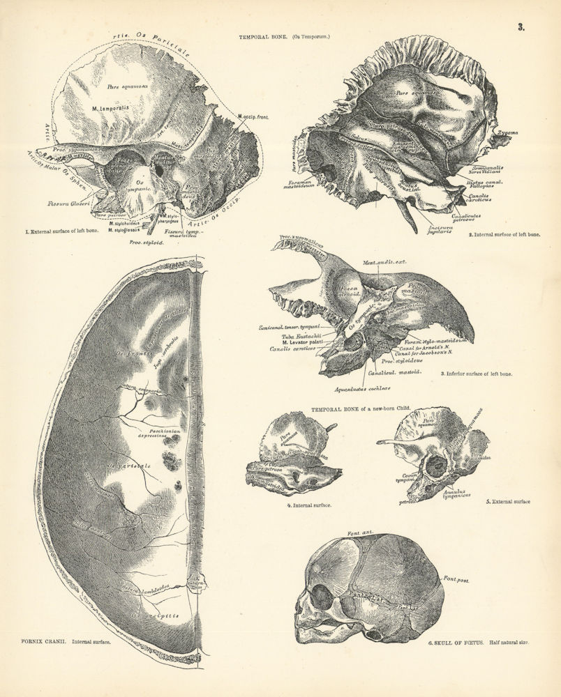 Associate Product Anatomy. Temporal Bone Adult & New-Born. Foetus Skull. Fornix Cranii 1880