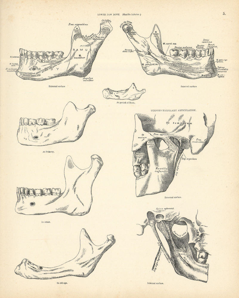 Anatomy. Lower Jaw Bones. Temporo-Maxillary Articulation 1880 old print