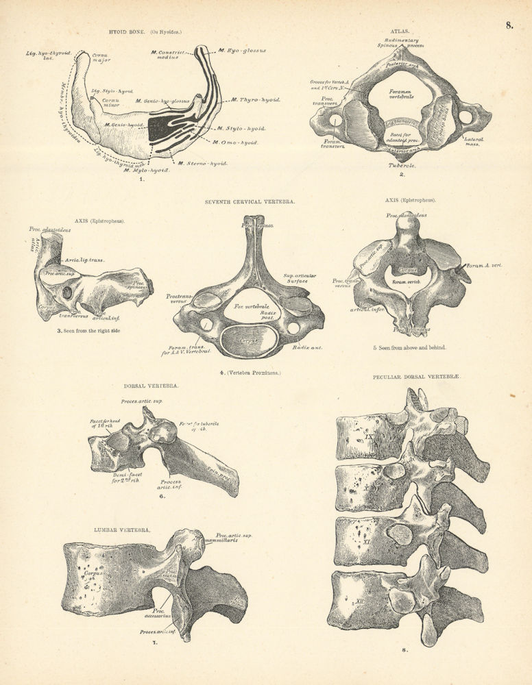 Anatomy. Hyoid Bone, Cervical, Dorsal, Peculiar Vertebrae & Atlas 1880 print