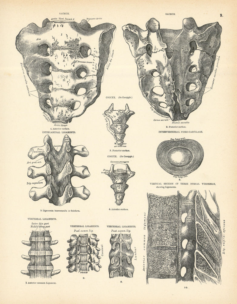 Anatomy. Sacrum, Coccyx, Ligaments, Cartilage, Dorsal Vertebrae 1880 old print