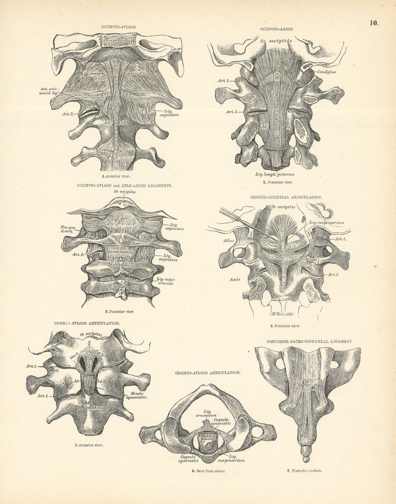 Associate Product Anatomy. Occipito-Atlantoid & Axoid Joints, Odonto-Articulations, Ligaments 1880