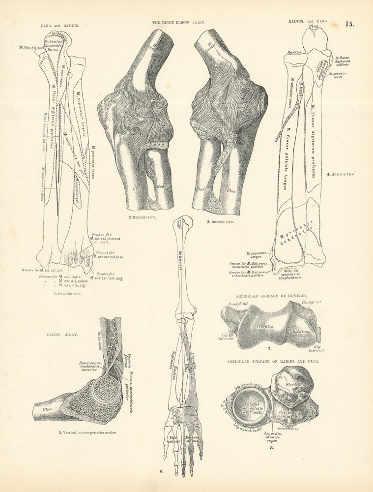 Anatomy. Ulna, Radius, Right Elbow Joint, Articular Surfaces 1880 old print