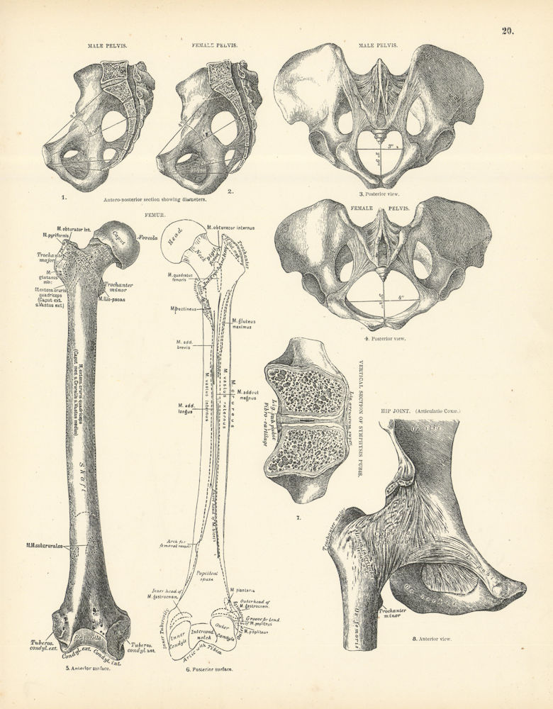 Associate Product Anatomy. Male & Female Pelvis, Femur, Hip Joint 1880 old antique print picture