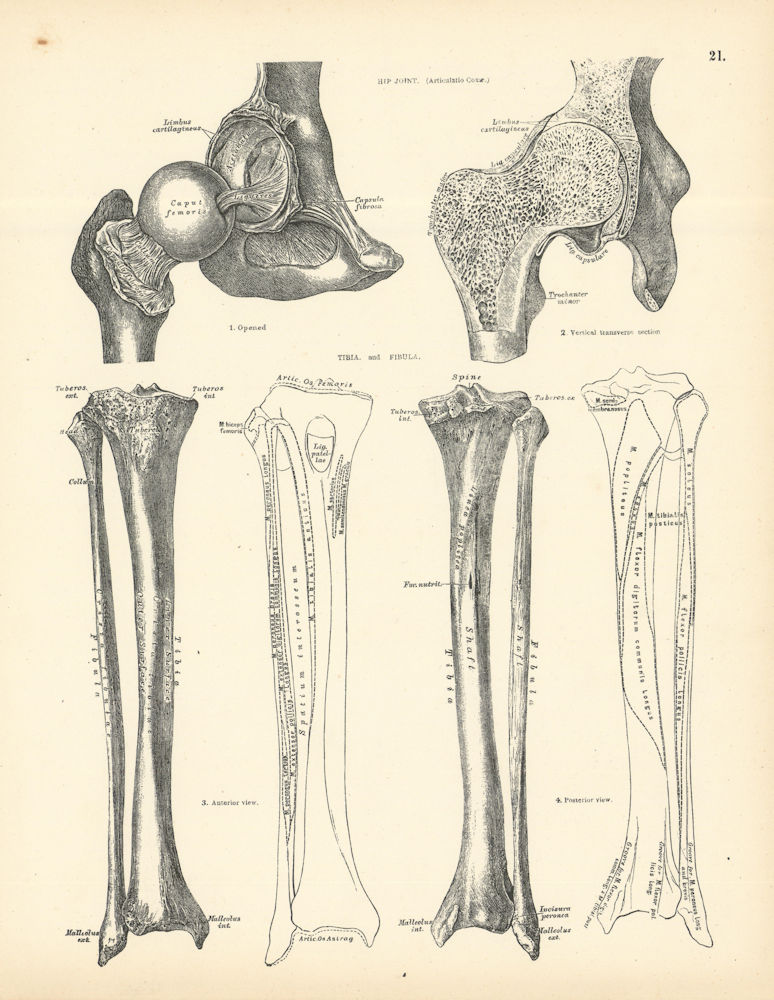 Anatomy. Hip Joint, Tibia, Fibula 1880 old antique vintage print picture