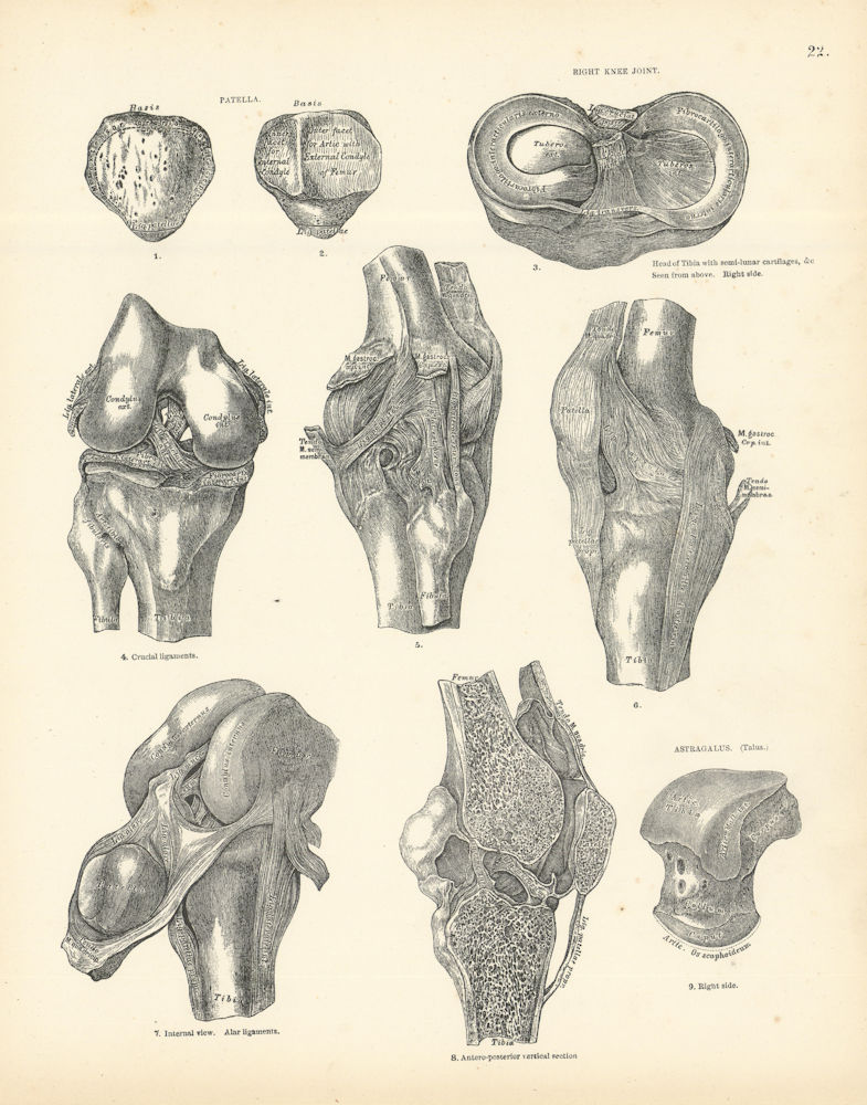 Associate Product Anatomy. Patella, Right Knee Joint, Astragalus 1880 old antique print picture