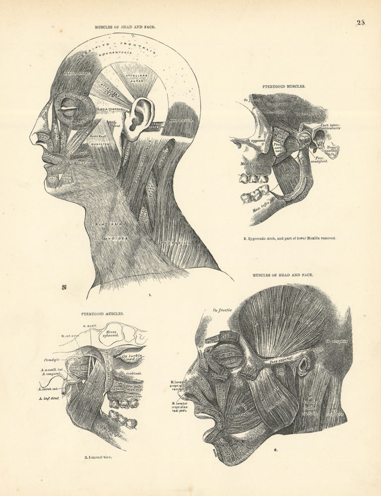 Anatomy. Muscles of Head & Face, Pterygoid Muscles 1880 old antique print