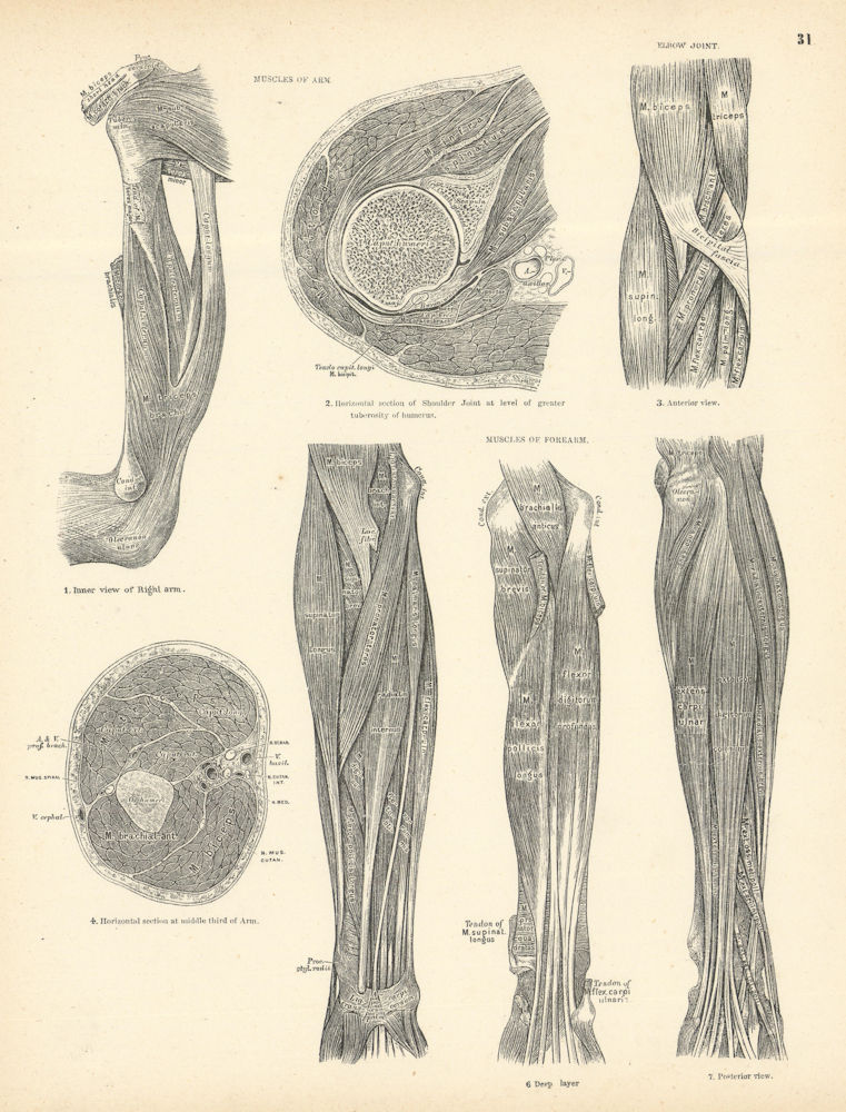 Associate Product Anatomy. Muscles of Arm, Forearm, Elbow Joint 1880 old antique print picture