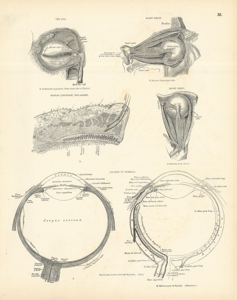 Associate Product Anatomy. Eye, Right Orbit, Enlarged Eyelid, Eyeball Section 1880 old print