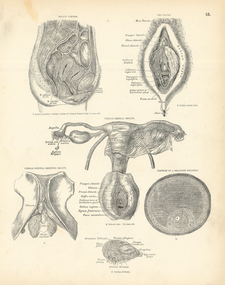 Anatomy. Female Genital Organs Pelvic Viscera Vulva Graafian Follicle Ovary 1880