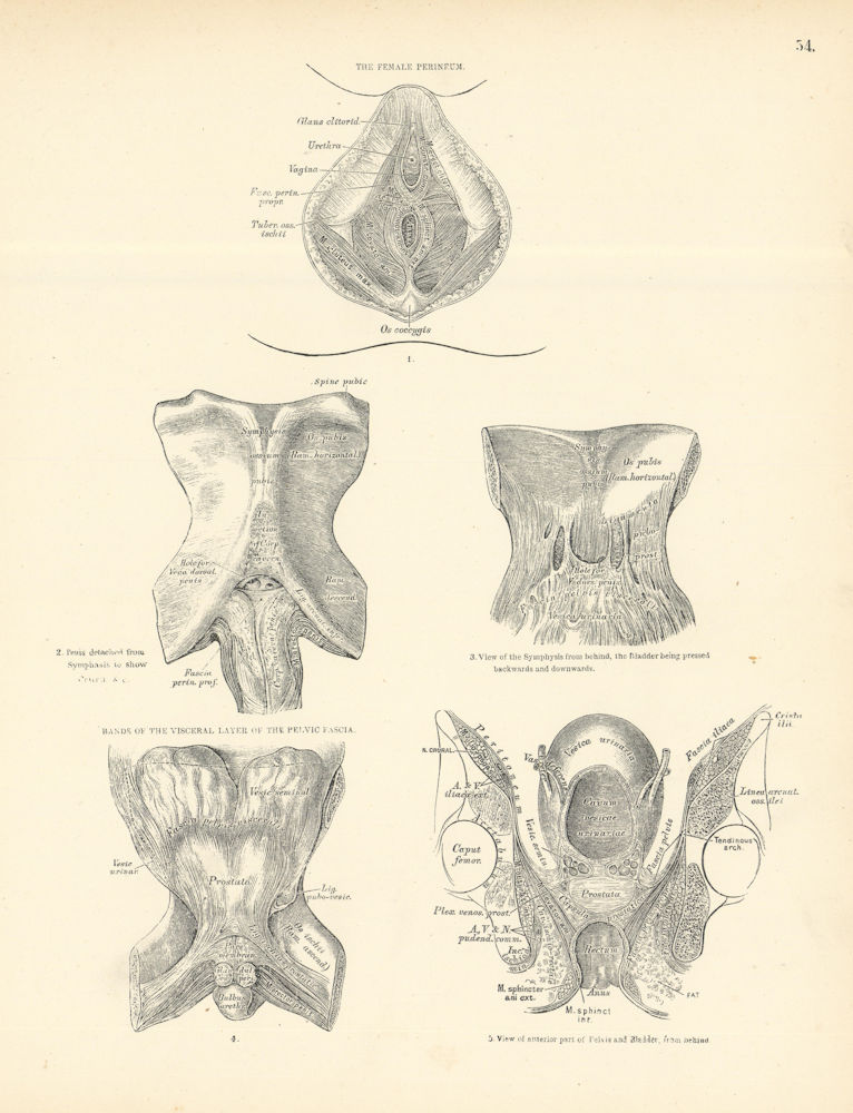 Anatomy. Female Perineum, Pelvic Fascia Bands 1880 old antique print picture