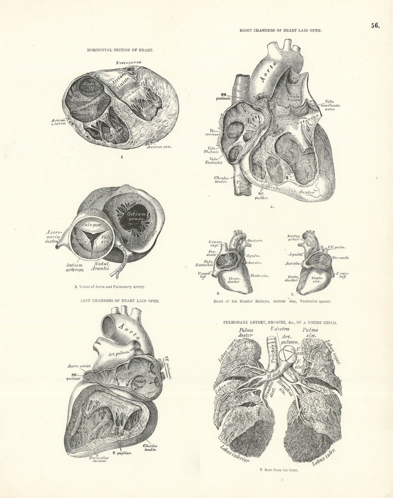 Associate Product Anatomy. Heart Horizontal Section, Right & Left Chambers, Pulmonary Artery 1880