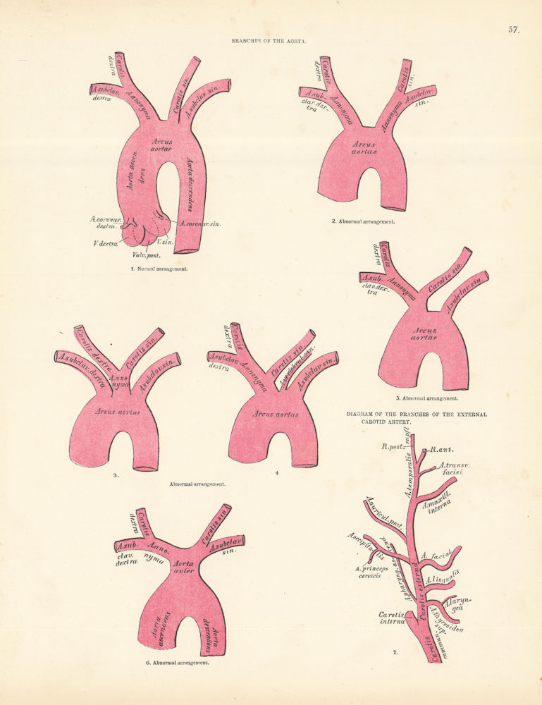 Anatomy. Aorta Branches, External Carotid Artery Diagram 1880 old print