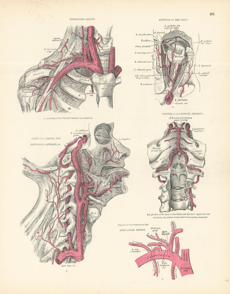 Anatomy. Subclavian Artery, Orbit, Internal Carotid & Vertebral Arteries 1880