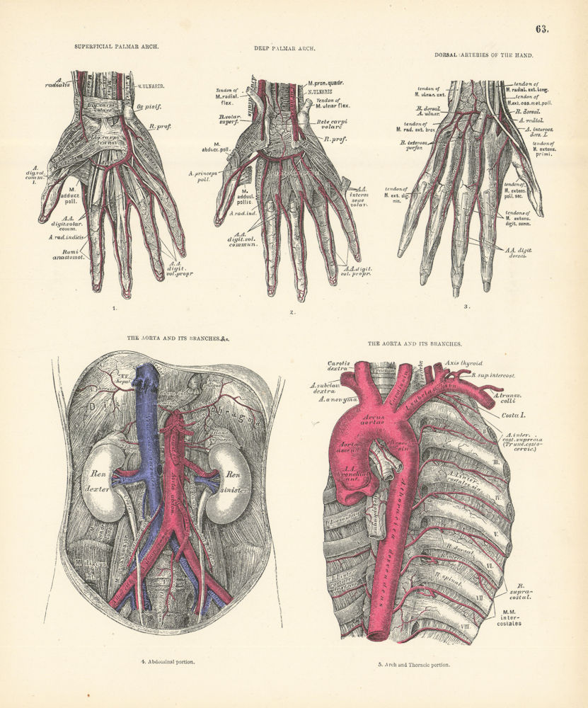 Anatomy. Deep & Superficial Palmar Arches, Hand Dorsal Arteries, Aorta 1880