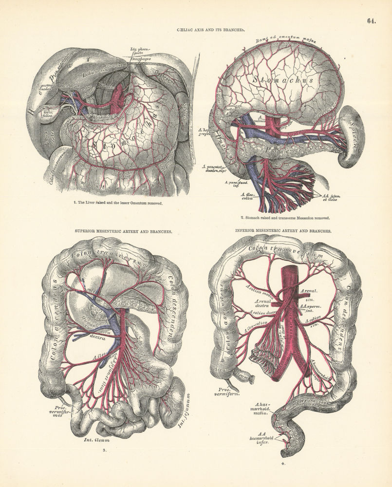 Associate Product Anatomy. Coeliac Axis & Branches, Superior & Inferior Mesenteric Arteries 1880