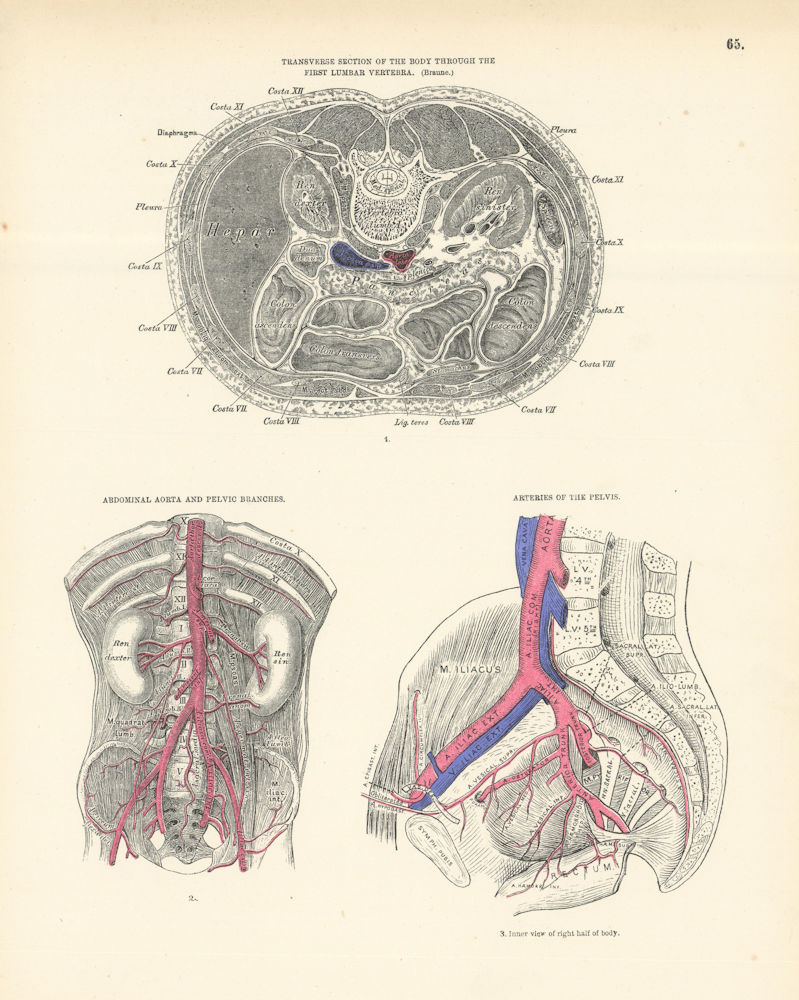 Anatomy. Lumbar Vertebra, Abdominal Aorta, Pelvic Branches 1880 old print