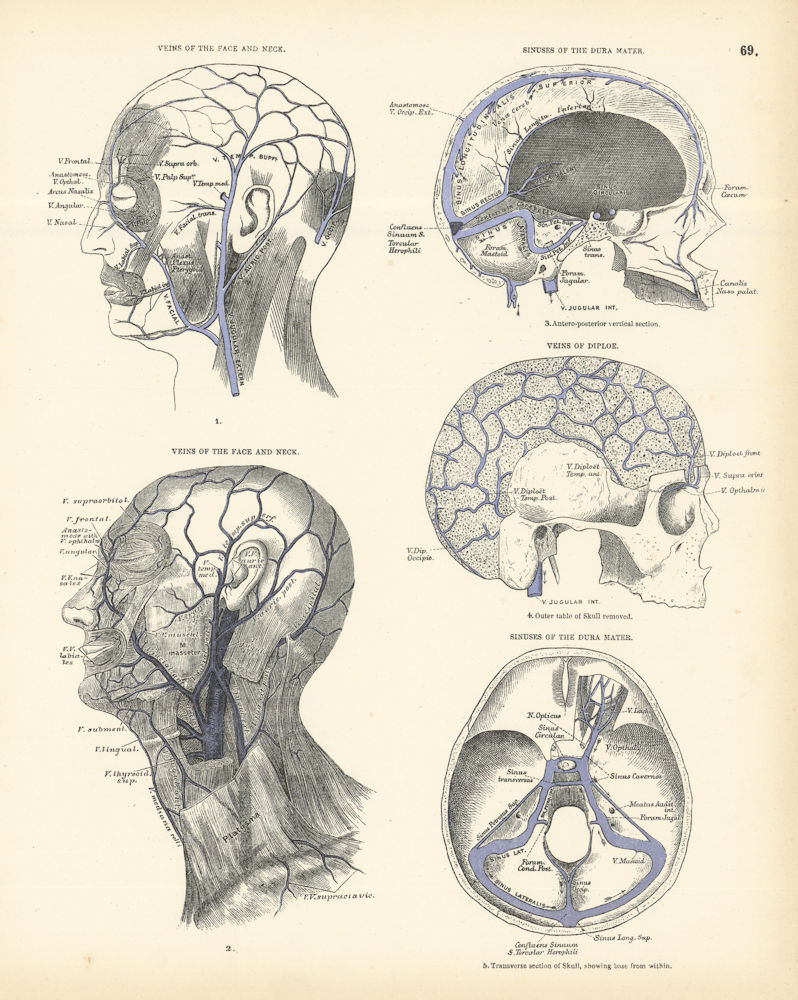 Anatomy. Face & Neck Veins, Dura Mater Sinuses, Diploe Veins 1880 old print