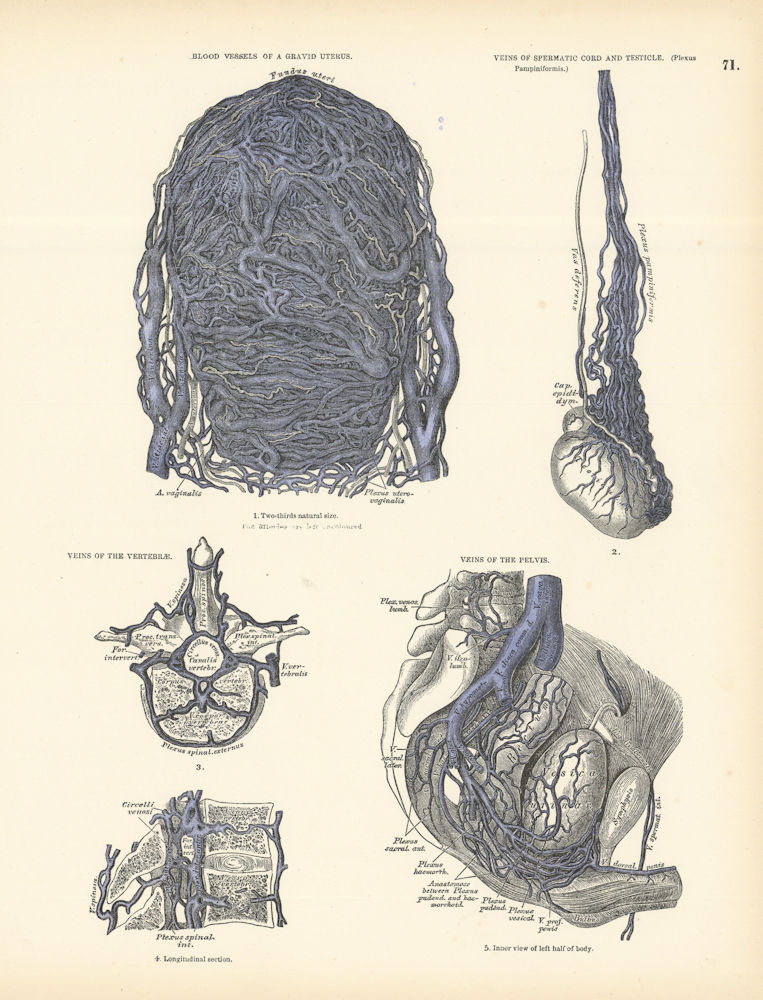 Associate Product Anatomy. Gravid Uterus Blood Vessels, Testicle, Vertebrae, Pelvis Veins 1880