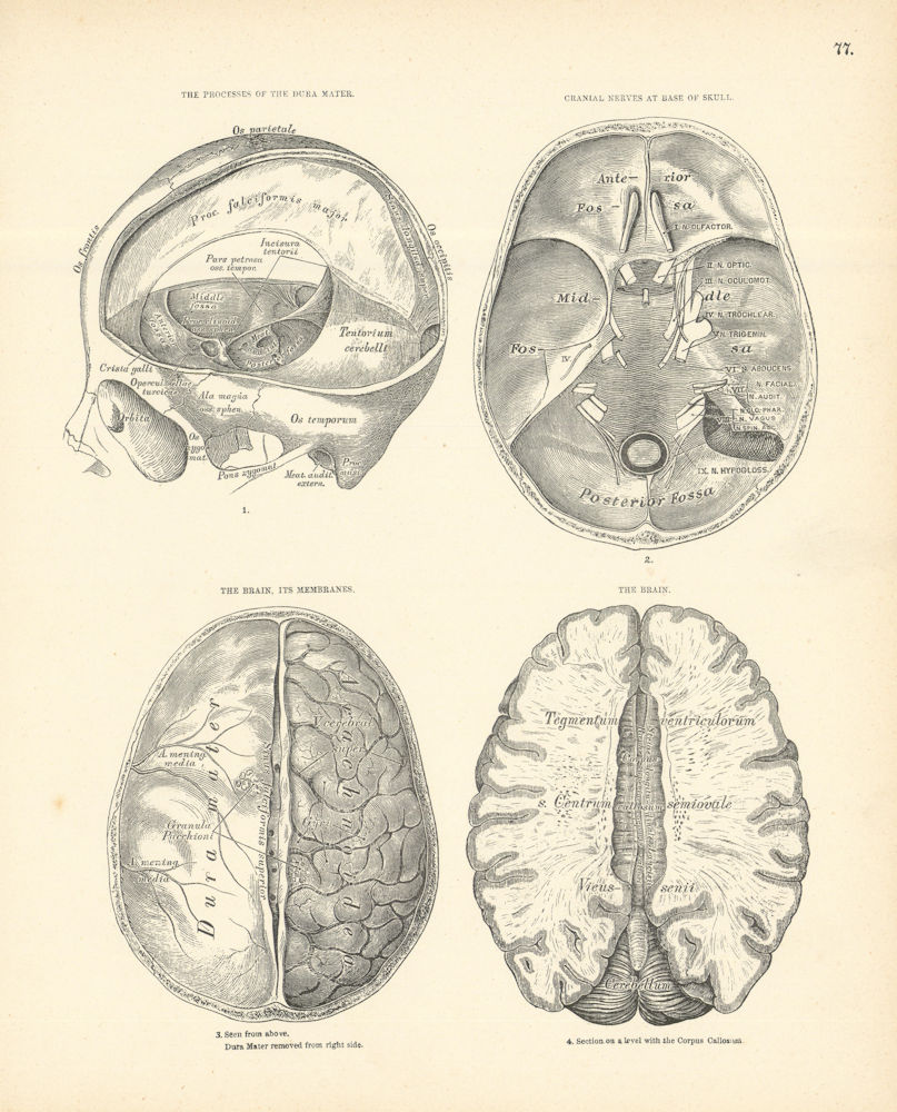 Associate Product Anatomy. Processes of Dura Mater, Cranial Nerves, Brain & Membranes 1880 print