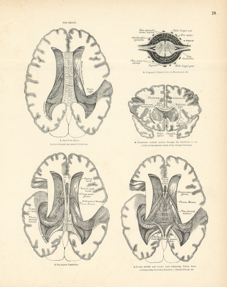 Anatomy. The Brain 1880 old antique vintage print picture