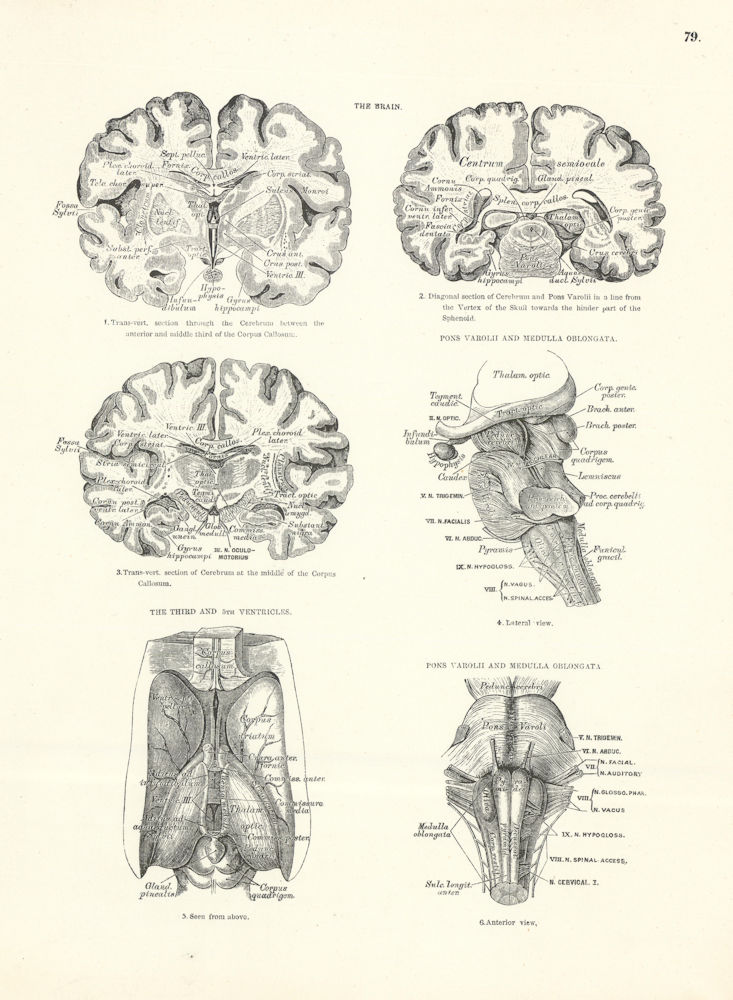 Anatomy. Brain, Pons Varolii, Medulla Oblongata, 3rd & 5th Ventricles 1880