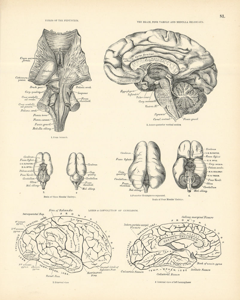 Anatomy. Fibres of Peduncles, Brain, Pons Varolii, Medulla, Cerebrum 1880