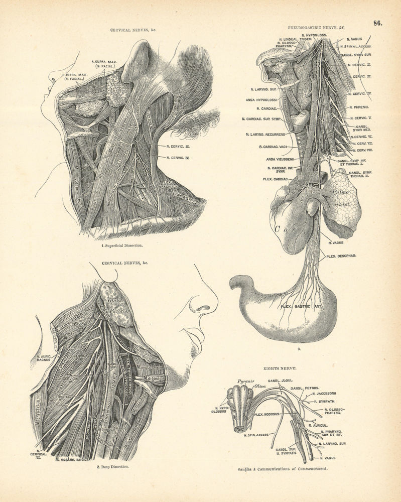 Anatomy. Cervical & Pneumogastric Nerves, Eighth Nerve 1880 old antique print