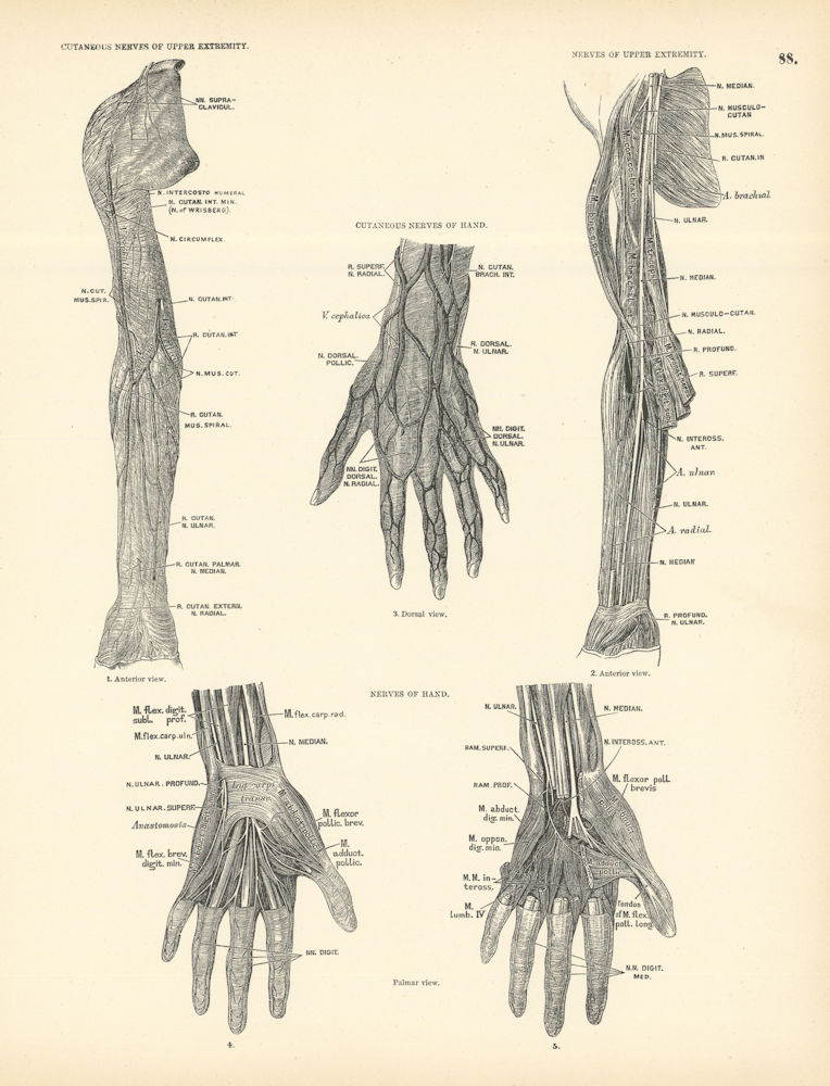 Anatomy. Cutaneous Nerves of Upper Extremity & Hand 1880 old antique print